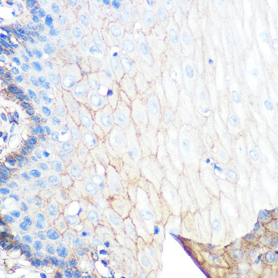 S100A10 Antibody in Immunohistochemistry (Paraffin) (IHC (P))