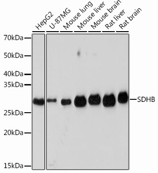 SDHB Antibody in Western Blot (WB)
