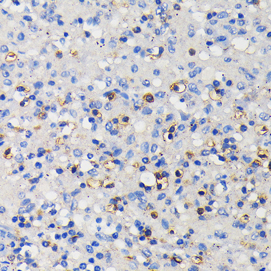 CD11a Antibody in Immunohistochemistry (Paraffin) (IHC (P))