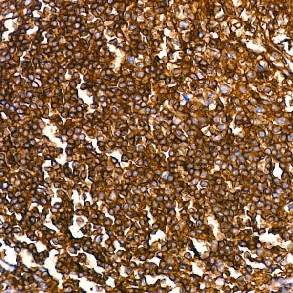 CD45 Antibody in Immunohistochemistry (Paraffin) (IHC (P))