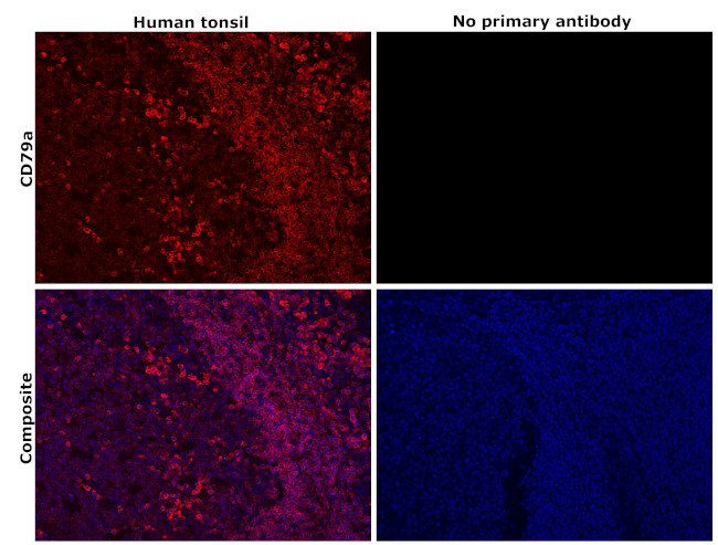 CD79a Antibody in Immunohistochemistry (Paraffin) (IHC (P))