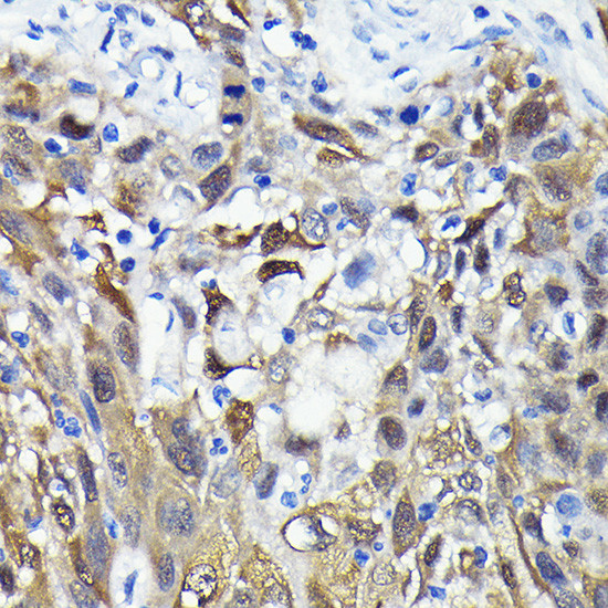 4EBP1 Antibody in Immunohistochemistry (Paraffin) (IHC (P))