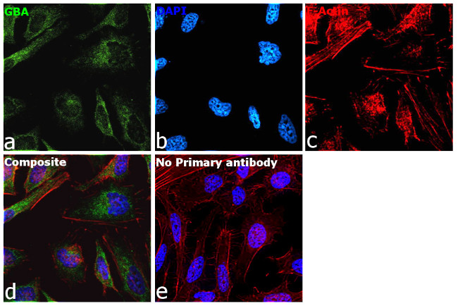 GBA Antibody in Immunocytochemistry (ICC/IF)