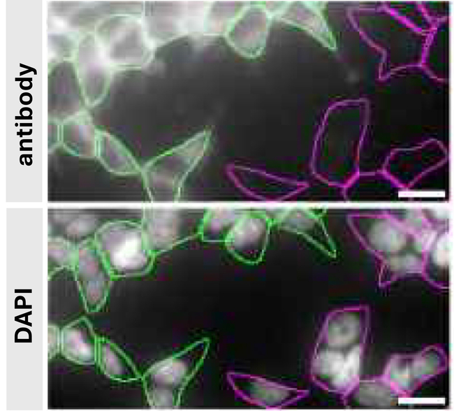 DJ-1 Antibody in Immunocytochemistry (ICC/IF)