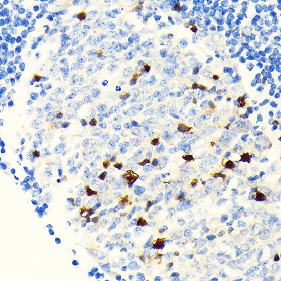 Parvalbumin Antibody in Immunohistochemistry (Paraffin) (IHC (P))