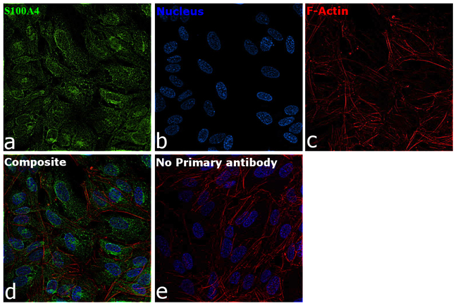 S100A4 Antibody in Immunocytochemistry (ICC/IF)