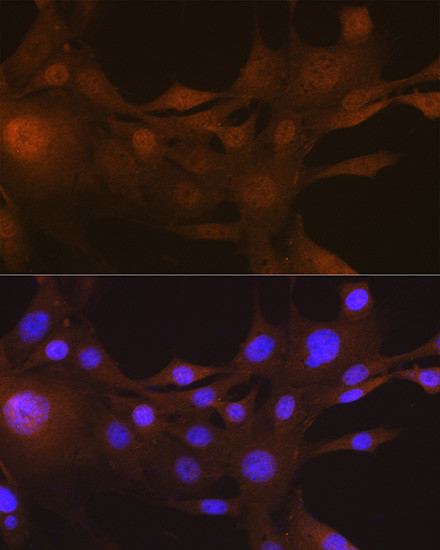 S100A4 Antibody in Immunocytochemistry (ICC/IF)