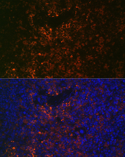 VCAM-1 (CD106) Antibody in Immunohistochemistry (Paraffin) (IHC (P))