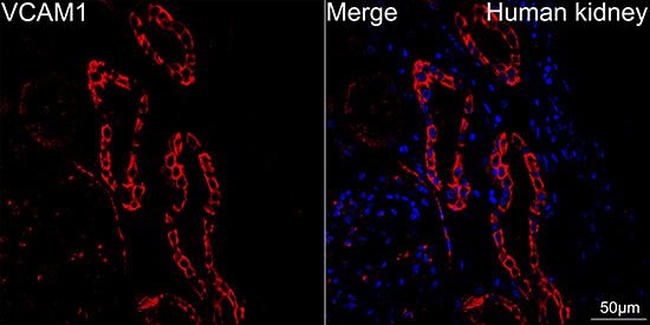 VCAM-1 (CD106) Antibody in Immunohistochemistry (Paraffin) (IHC (P))