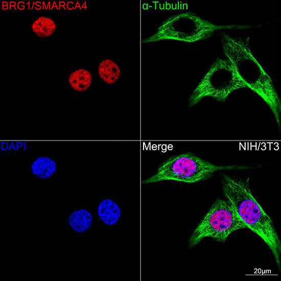BRG1 Antibody in Immunocytochemistry (ICC/IF)