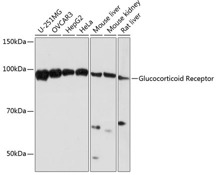 Glucocorticoid Receptor Antibody in Western Blot (WB)