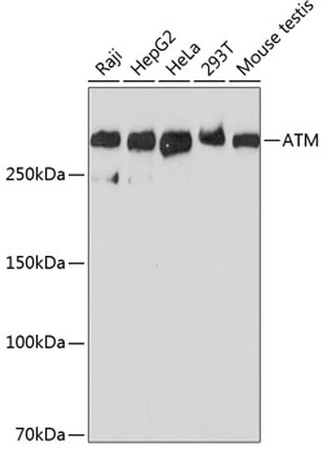 ATM Antibody MA5 35332 atm-antibody-ma5-35332