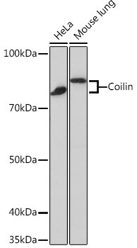 Coilin Antibody in Western Blot (WB)