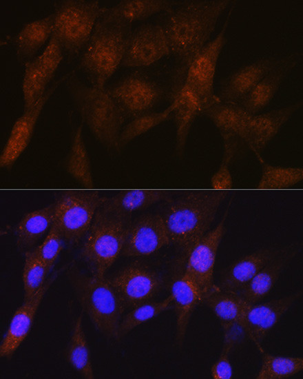 PSMD4 Antibody in Immunocytochemistry (ICC/IF)