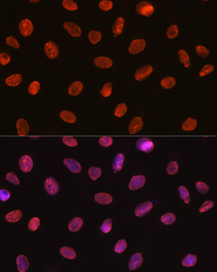 SNRPA Antibody in Immunocytochemistry (ICC/IF)