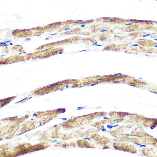 FBXO32 Antibody in Immunohistochemistry (Paraffin) (IHC (P))