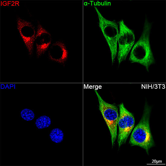 IGF2R Antibody in Immunocytochemistry (ICC/IF)