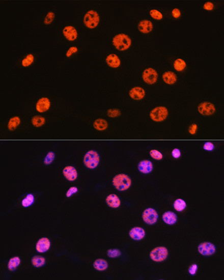 BAF57 Antibody in Immunocytochemistry (ICC/IF)