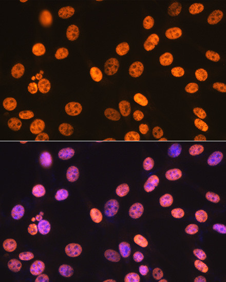 SAM68 Antibody in Immunocytochemistry (ICC/IF)