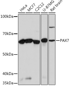 PAX7 Antibody in Western Blot (WB)