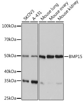 BMP-15 Antibody in Western Blot (WB)