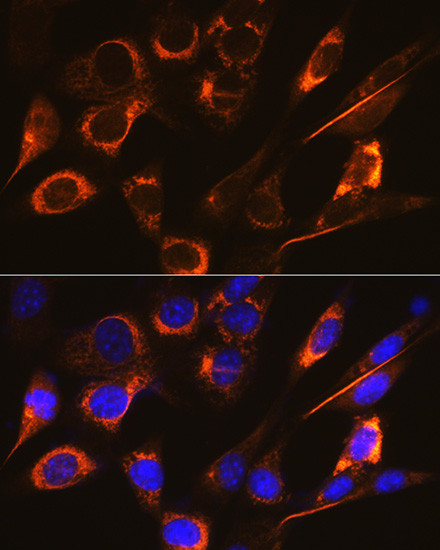 SFRP4 Antibody in Immunocytochemistry (ICC/IF)