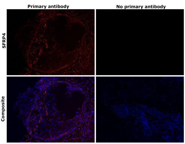 SFRP4 Antibody in Immunohistochemistry (Paraffin) (IHC (P))