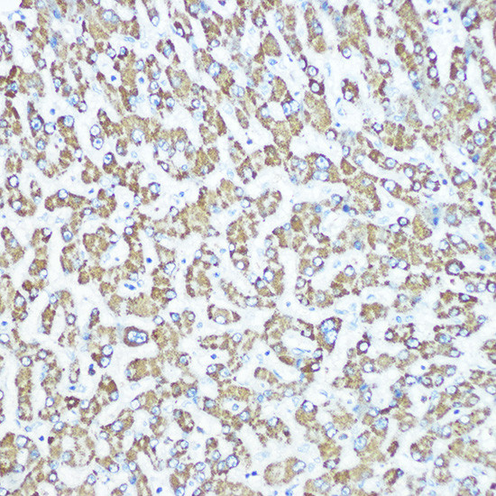 CPS1 Antibody in Immunohistochemistry (Paraffin) (IHC (P))