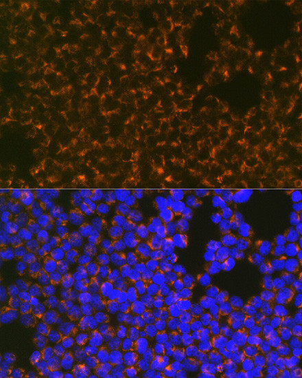 CCR8 Antibody in Immunocytochemistry (ICC/IF)