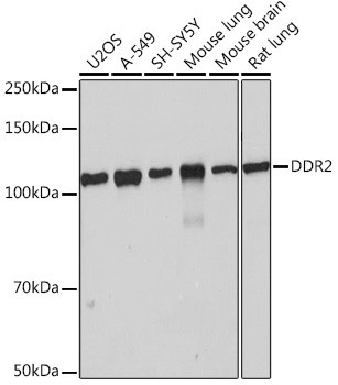 DDR2 Antibody in Western Blot (WB)