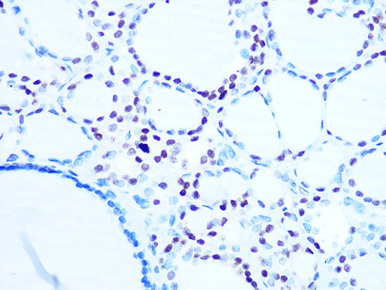 Histone H1.0 Antibody in Immunohistochemistry (Paraffin) (IHC (P))