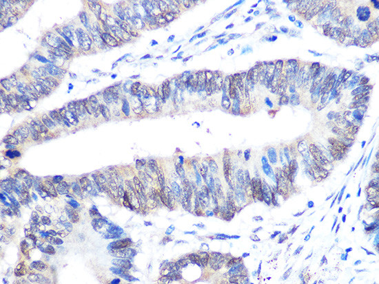 UBC9 Antibody in Immunohistochemistry (Paraffin) (IHC (P))