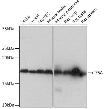 eIF5A Antibody in Western Blot (WB)