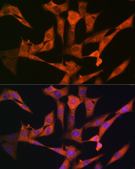 USP10 Antibody in Immunocytochemistry (ICC/IF)