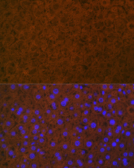 Protein C Antibody in Immunohistochemistry (Paraffin) (IHC (P))