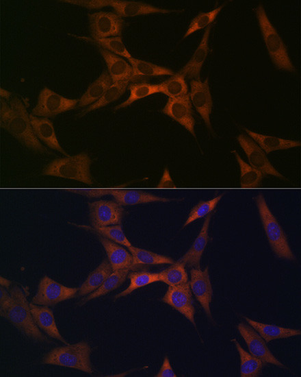 BMP6 Antibody in Immunocytochemistry (ICC/IF)