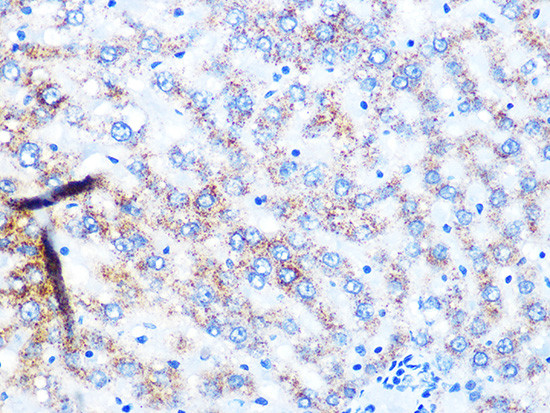 NDUFS3 Antibody in Immunohistochemistry (Paraffin) (IHC (P))