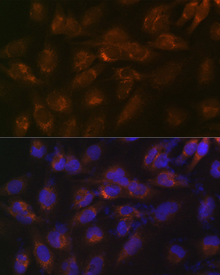 IGFBP7 Antibody in Immunocytochemistry (ICC/IF)