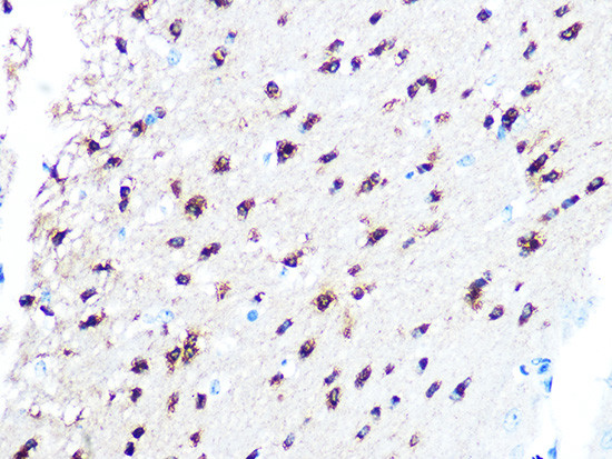 TPPP Antibody in Immunohistochemistry (Paraffin) (IHC (P))