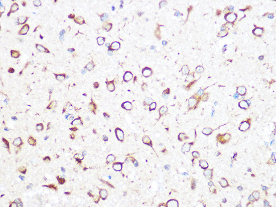 TCP-1 beta Antibody in Immunohistochemistry (Paraffin) (IHC (P))