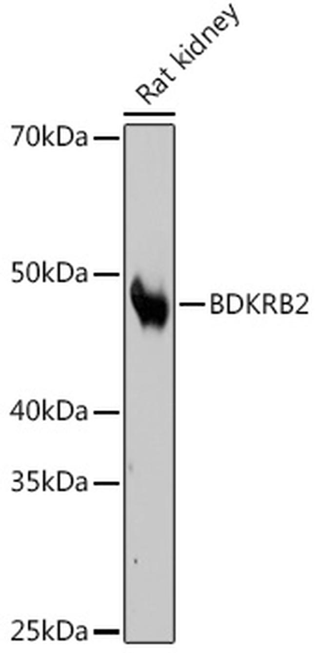BDKRB2 Antibody in Western Blot (WB)