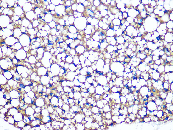 Perilipin 1 Antibody in Immunohistochemistry (Paraffin) (IHC (P))