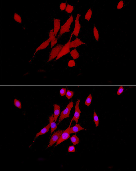 ERK1/2 Antibody in Immunocytochemistry (ICC/IF)