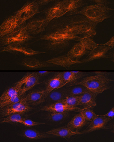 beta Tubulin 2 Antibody in Immunocytochemistry (ICC/IF)