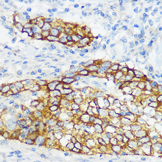 COL17A1 Antibody in Immunohistochemistry (Paraffin) (IHC (P))