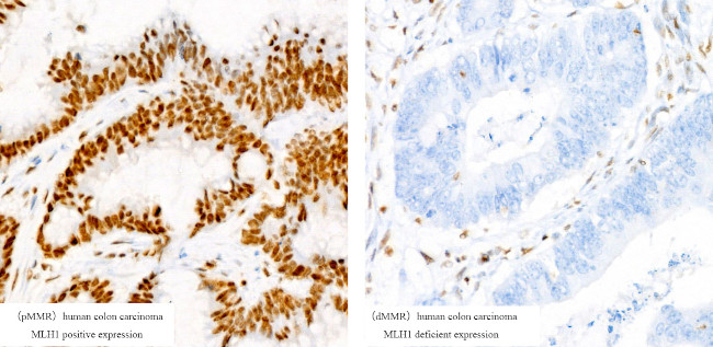 MLH1 Antibody in Immunohistochemistry (Paraffin) (IHC (P))