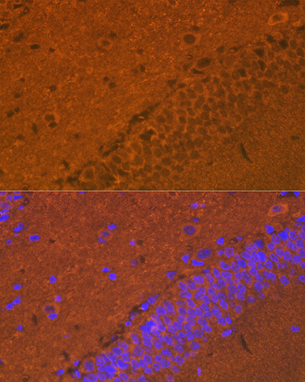 Synuclein alpha/beta Antibody in Immunohistochemistry (Paraffin) (IHC (P))