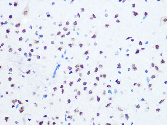 OGG1 Antibody in Immunohistochemistry (Paraffin) (IHC (P))