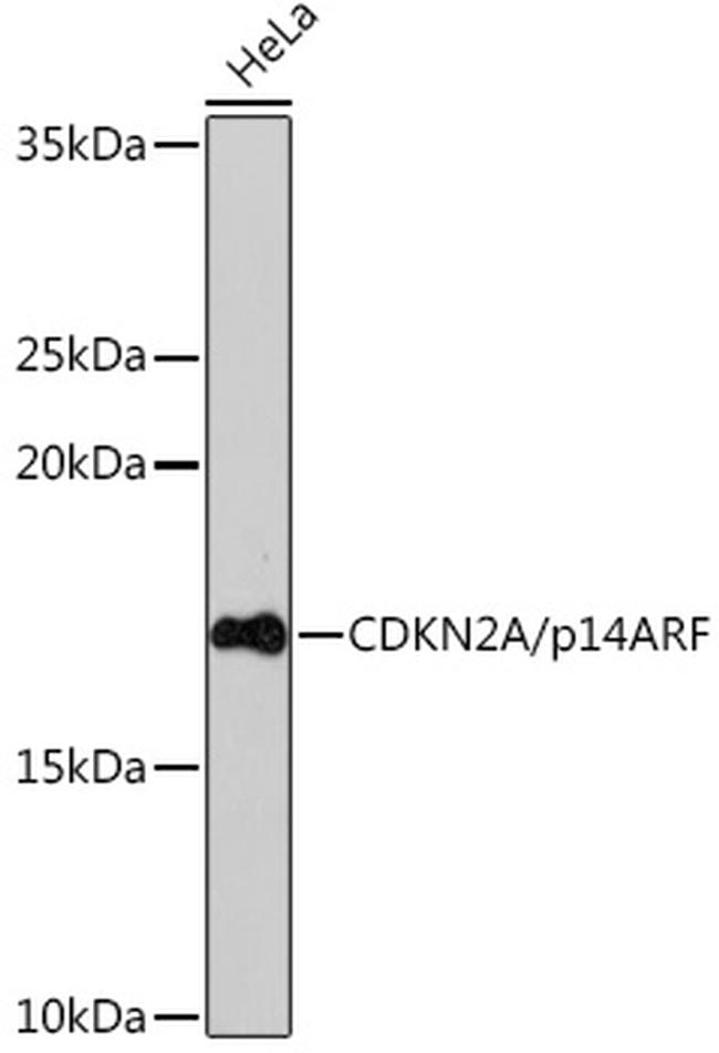 p14ARF Antibody in Western Blot (WB)