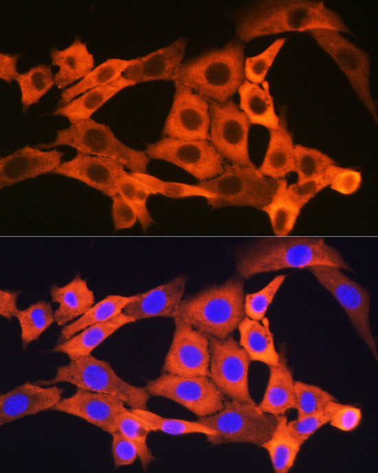 JNK1/JNK3 Antibody in Immunocytochemistry (ICC/IF)